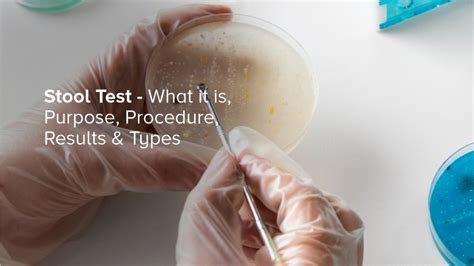 fecalysis test|Stool Test: What It Is, Purpose, Procedure, Results & Types.